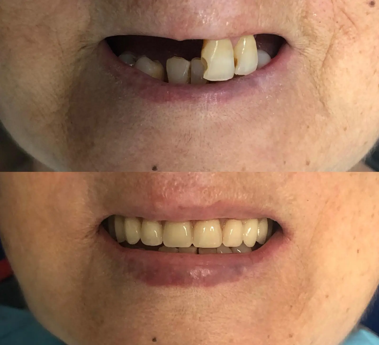 Antes e Depois - 5 (6)