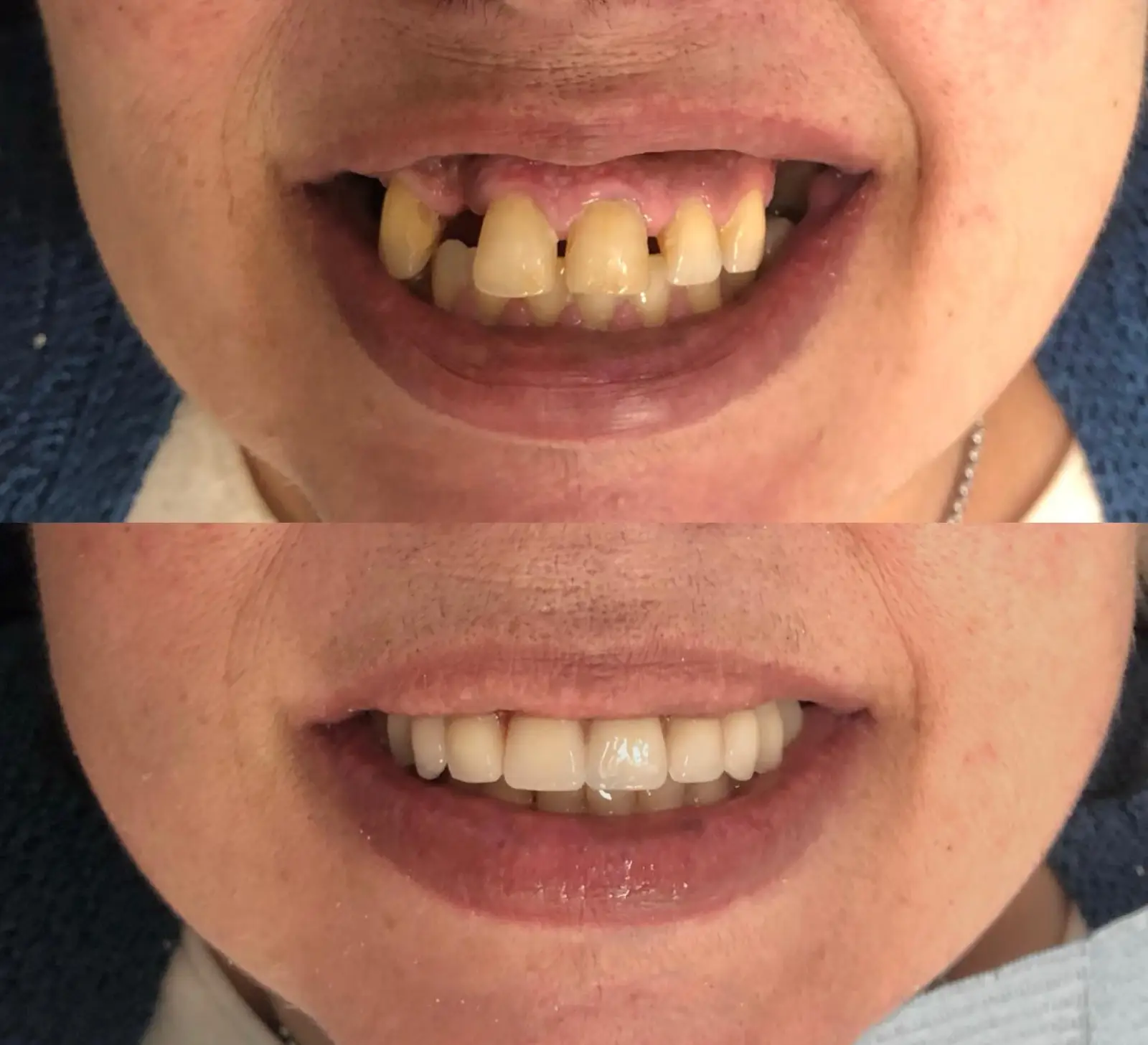 Antes e Depois - 5 (8)