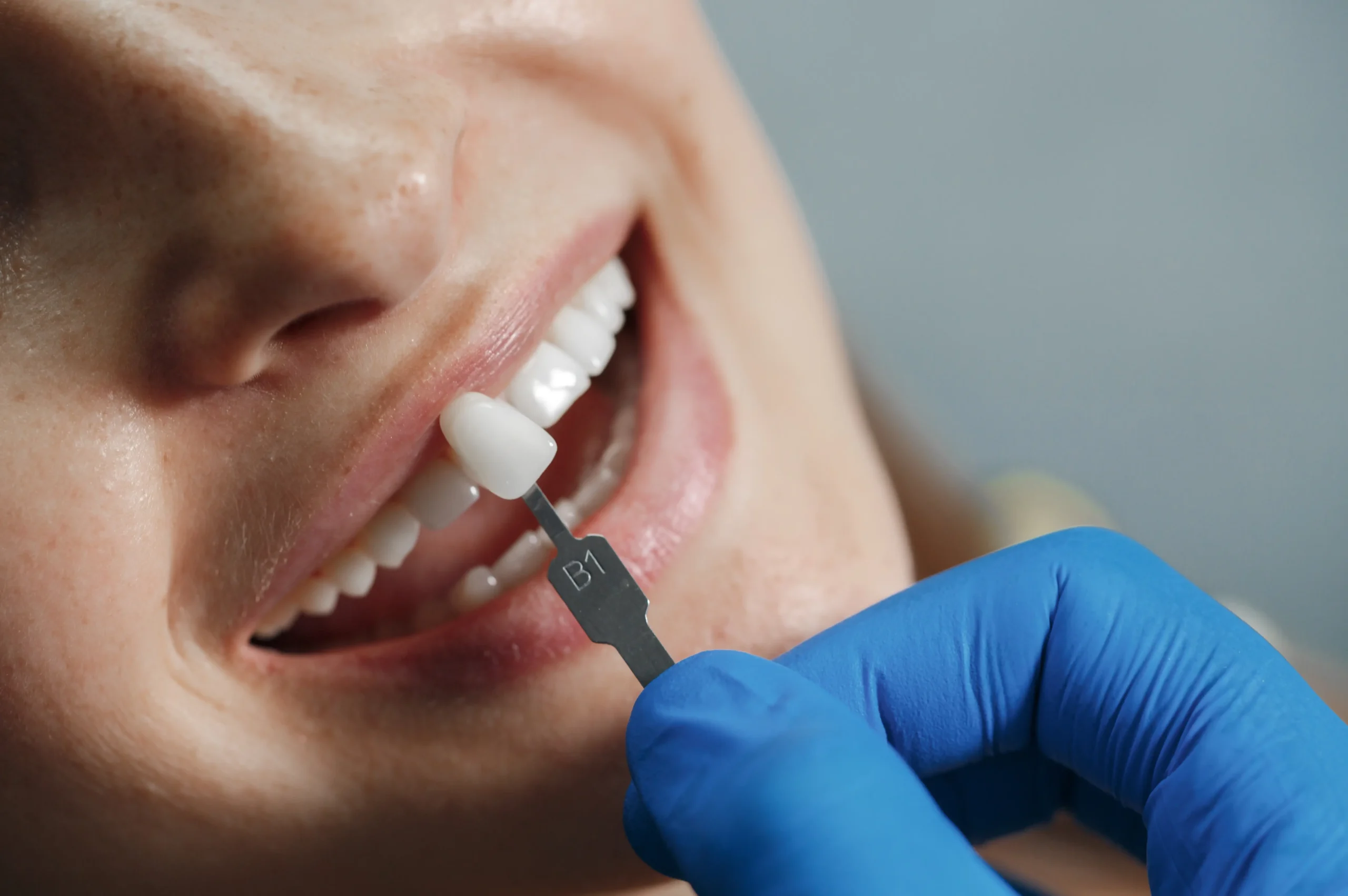 young-man-with-toothy-smile-demonstrating-his-dental-implant (1)