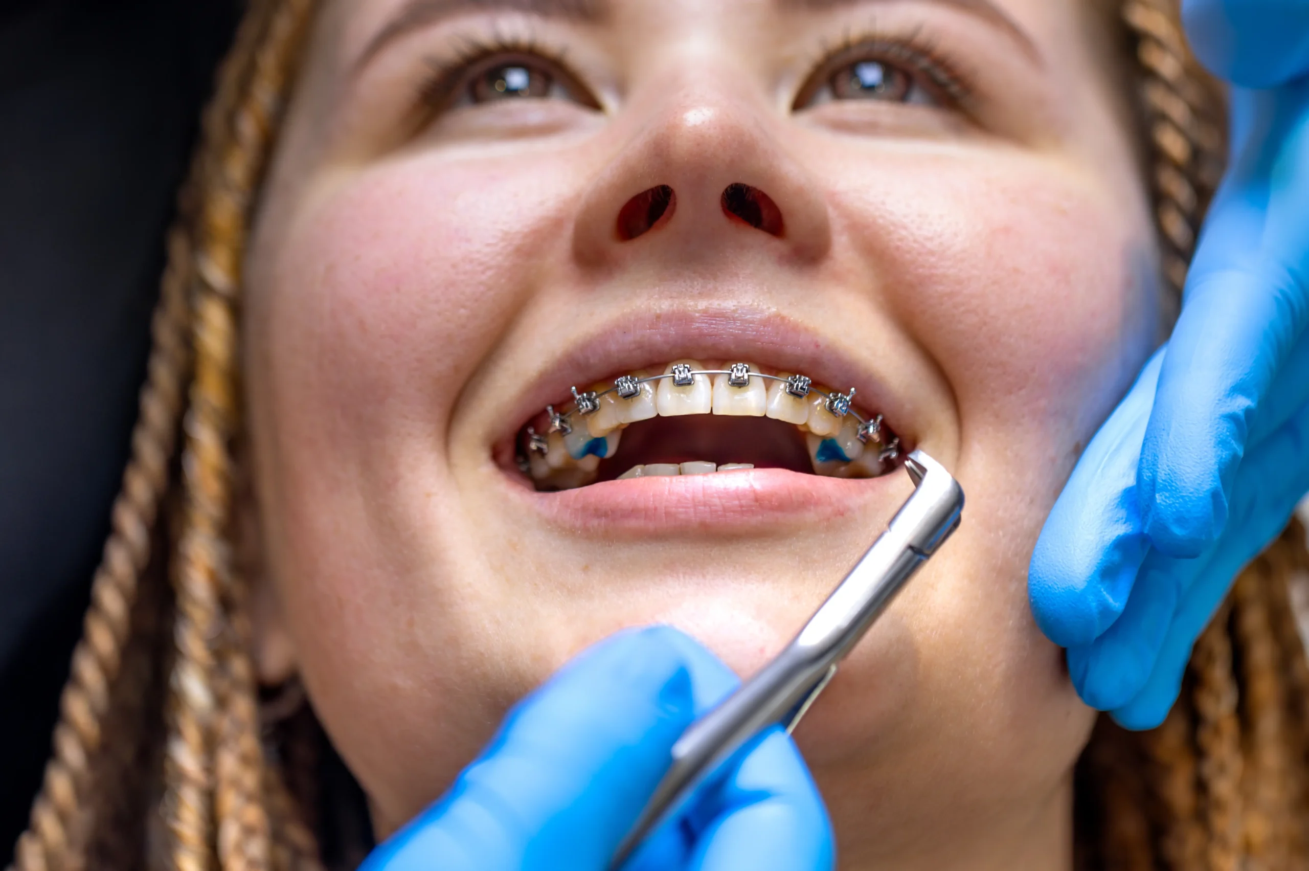 young-man-with-toothy-smile-demonstrating-his-dental-implant (5) (4)